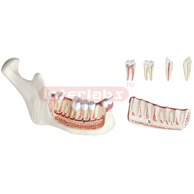 Jaw Model, Lower